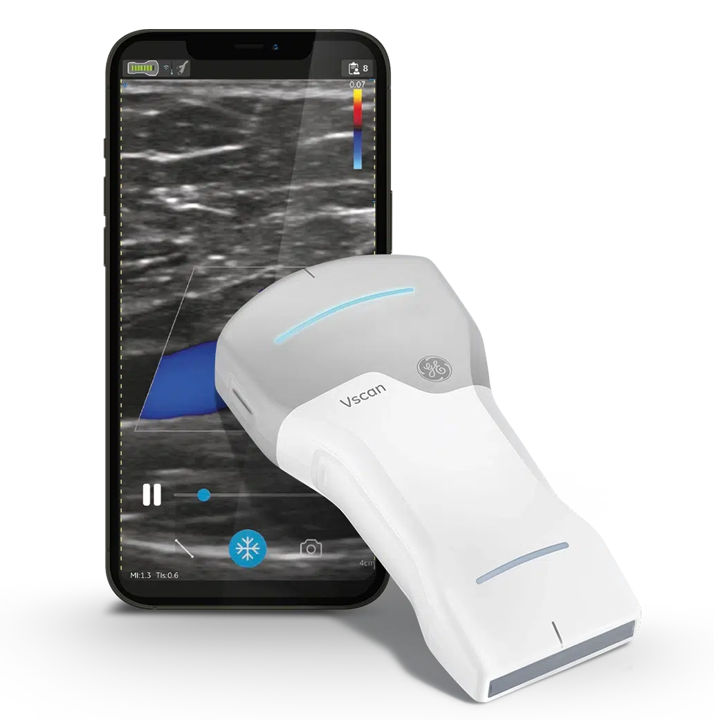 vscan air cl teaser neutral