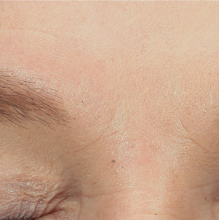 FACETOX - Pt 1 - BEFORE