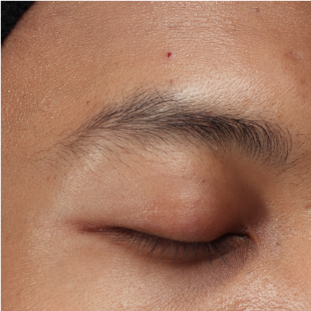 FACETOX - Pt 2 - AFTER